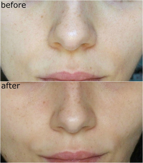 COSRX Advanced Snail 96 Mucin Power Essence